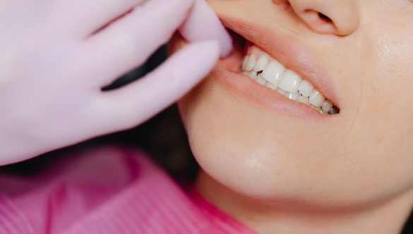 The Smile-Body Connection: How Oral Health Impacts Your Overall Well-being